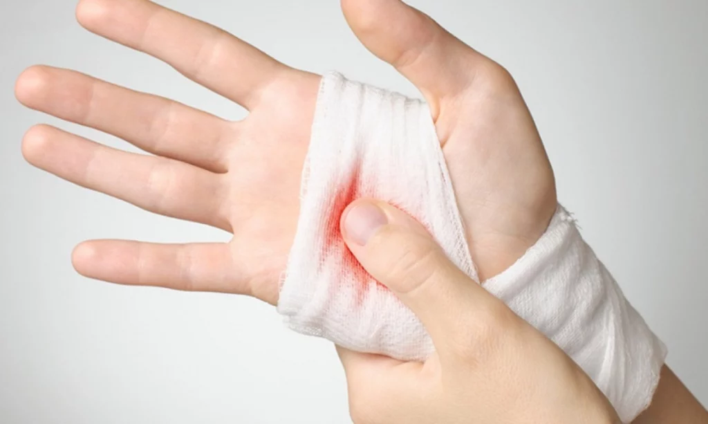 Який засіб допоможе зупинити розвиток бактеріальної інфекції та запалення після порізів чи укусів комах?